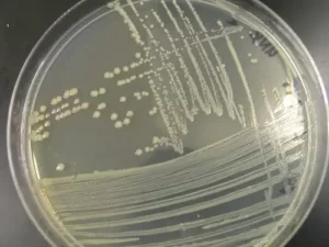 Isolation and identification of Escherichia coli...