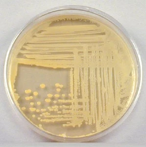 Isolation and Identification of Staphylococcus aureus