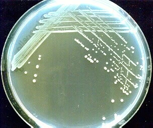Isolation and Identification of Salmonella typhi...