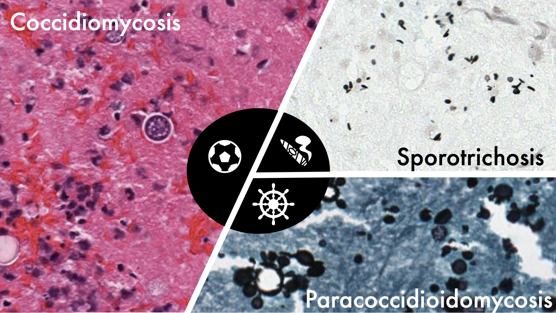 Histopathologic Analysis of Fungi — PathElective