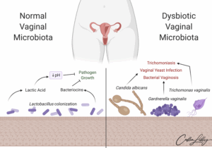 Vaginal Microbiota and Dysbiosis — PathElective