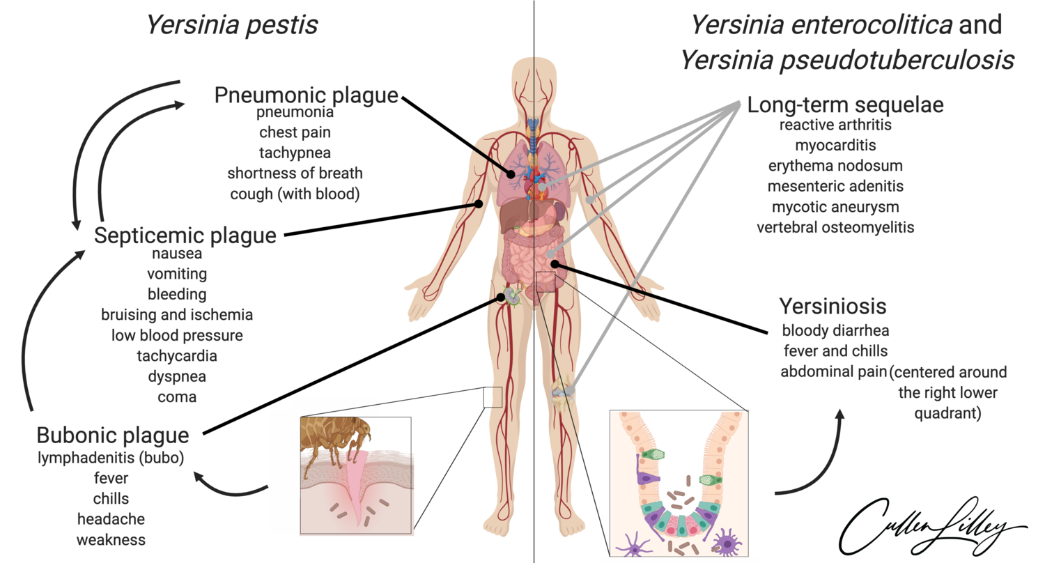 Symptomatology of Pathogenic Yersiniae — PathElective