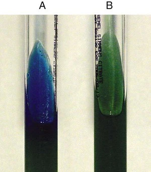 Acetamide Utilization Test – An overview