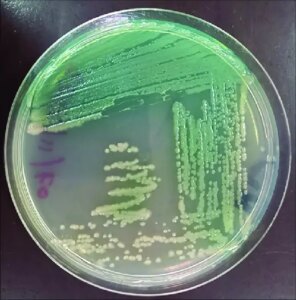 Isolation and identification of P. aeruginosa